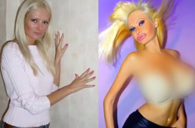  Facial Feature Collapse...