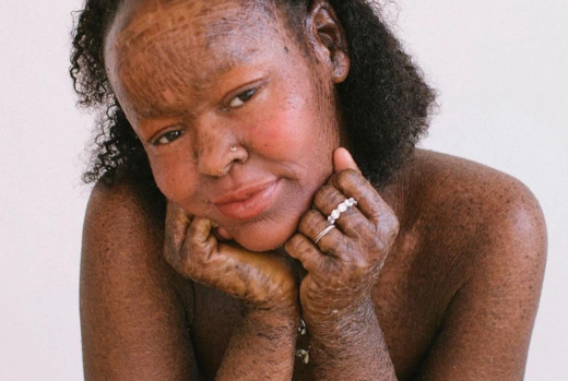 “I’m Allowed to Be Beautiful “I’m Allowed to Be Beautiful