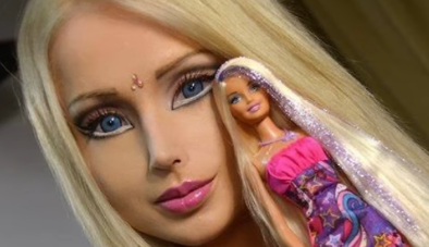 10 Most Extreme Celebrity Plastic Surgery Disasters: Facial Fusion