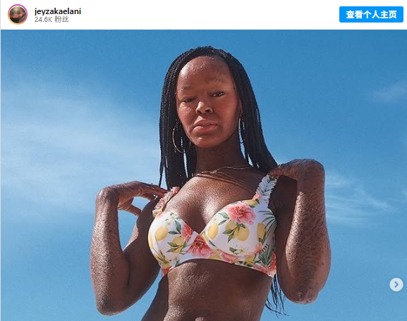 “I’m Allowed to Be Beautiful “I’m Allowed to Be Beautiful