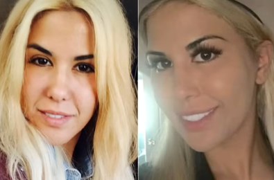 10 Most Extreme Celebrity Plastic Surgery Disasters: Facial Fusion