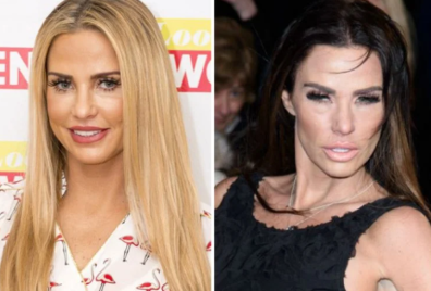 10 Most Extreme Celebrity Plastic Surgery Disasters: Facial Fusion